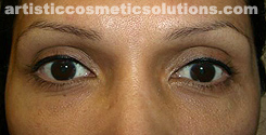 permanent eyeliner