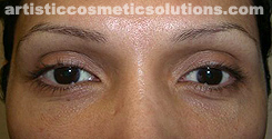permanent eyeliner
