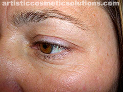 permanent eyeliner