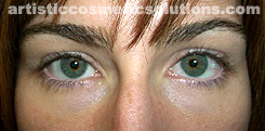 Permanent Eyeliner (Medium, Upper and Lower Eyelids)
