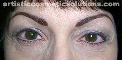 Permanent Eyeliner (Medium, Upper and Lower Eyelids)