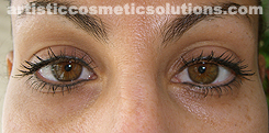 Permanent Eyeliner (Medium, Upper and Lower Eyelids)