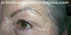 Permanent Eyeliner (Medium, Upper and Lower Eyelids)