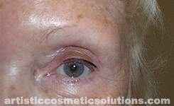 Hair Stroke Permanent Eyebrows