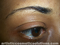 Permanent Eyebrow Completion (Hairstroke Technique)