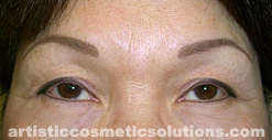 Permanent Eyeliner (Medium, Upper and Lower Eyelids)