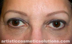 permanent eyeliner