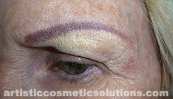 cosmetic tattooing, tattooed makeup