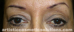 permanent makeup correction
