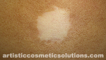 scar color camouflage
